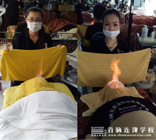 容班学员做头部火疗